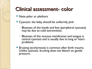 Clinical assessment- color
 Note

palor or plethora

 Cyanosis:

the baby should be uniformly pink

◦ Blueness of the hands and feet (peripheral cyanosis)
may be due to cold extremeties.
◦ Blueness of the mucous membranes and tongue is
central cyanosis and is usually due to lung or heart
problems
 Bruising

(ecchymosis) is common after birth trauma.
Unlike cyanosis, bruising does not blanch on gentle
pressure.

 