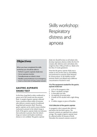 Skills workshop:
                                                      Respiratory
                                                      distress and
                                                      apnoea


                                                      shake test should be done on all infants who
 Objectives                                           develop respiratory distress within the first 30
                                                      minutes after delivery and in all infants who
                                                      weigh less than 1500 g at birth (i.e. likely to be
 When you have completed this skills                  less than 35 weeks gestation).
 workshop you should be able to:
                                                      Note that the gastric aspirate shake test is
 • Perform a gastric aspirate shake test.             similar to, but not the same as, the bubbles
 • Use an apnoea monitor.                             test performed on amniotic fluid obtained
 • Transilluminate an infant’s chest.                 by amniocentesis. In the bubbles test the
 • Needle a pneumothorax in an emergency.             amniotic fluid is not diluted and a different
 • Insert a chest drain (if adequately trained).      concentration of alcohol is used.

                                                      10-a The equipment needed for the gastric
                                                      aspirate shake test
GASTRIC ASPIRATE
                                                      1. A F5 or F6 nasogastric tube
SHAKE TEST                                            2. Three 1 ml plastic syringes
                                                      3. A clean glass test tube
In the fetus, lung fluid is either swallowed or       4. An ampoule of normal saline
passes out of the mouth into the amniotic             5. A bottle of 95% alcohol with a tight-fitting
fluid. A sample of gastric aspirate collected            top
from a newborn infant within 30 minutes               6. A rubber stopper or piece of Parafilm
after delivery consists mainly of swallowed
lung fluid and amniotic fluid. Therefore,             10-b Collection of the gastric aspirate
gastric aspirate can be used to assess whether
surfactant is present in the infant’s lungs at        A nasogastric tube is passed after delivery
birth. If the gastric aspirate shake test indicates   and before the first feed is given. The
that surfactant is present, then the infant’s         stomach contents are aspirated into a plastic
lungs are mature and hyaline membrane                 syringe. The sample of gastric aspirate must
disease is very unlikely. The gastric aspirate        be collected within 30 minutes of birth.
                                                      Thereafter the stomach contents consist of
 