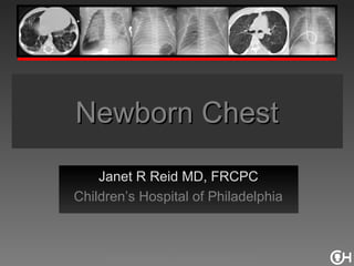 Newborn Chest
    Janet R Reid MD, FRCPC
Children’s Hospital of Philadelphia



     Fellow Radiology Lecture Series 2012
 