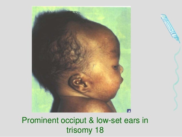 New born examination