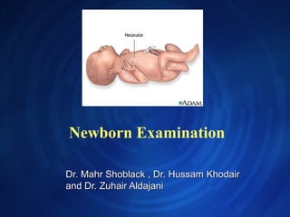 Newborn Examination
Dr. Mahr Shoblack , Dr. Hussam KhodairDr. Mahr Shoblack , Dr. Hussam Khodair
and Dr. Zuhair Aldajaniand Dr. Zuhair Aldajani
 
