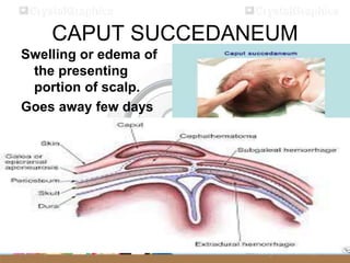 Newborn assessment | PPTX