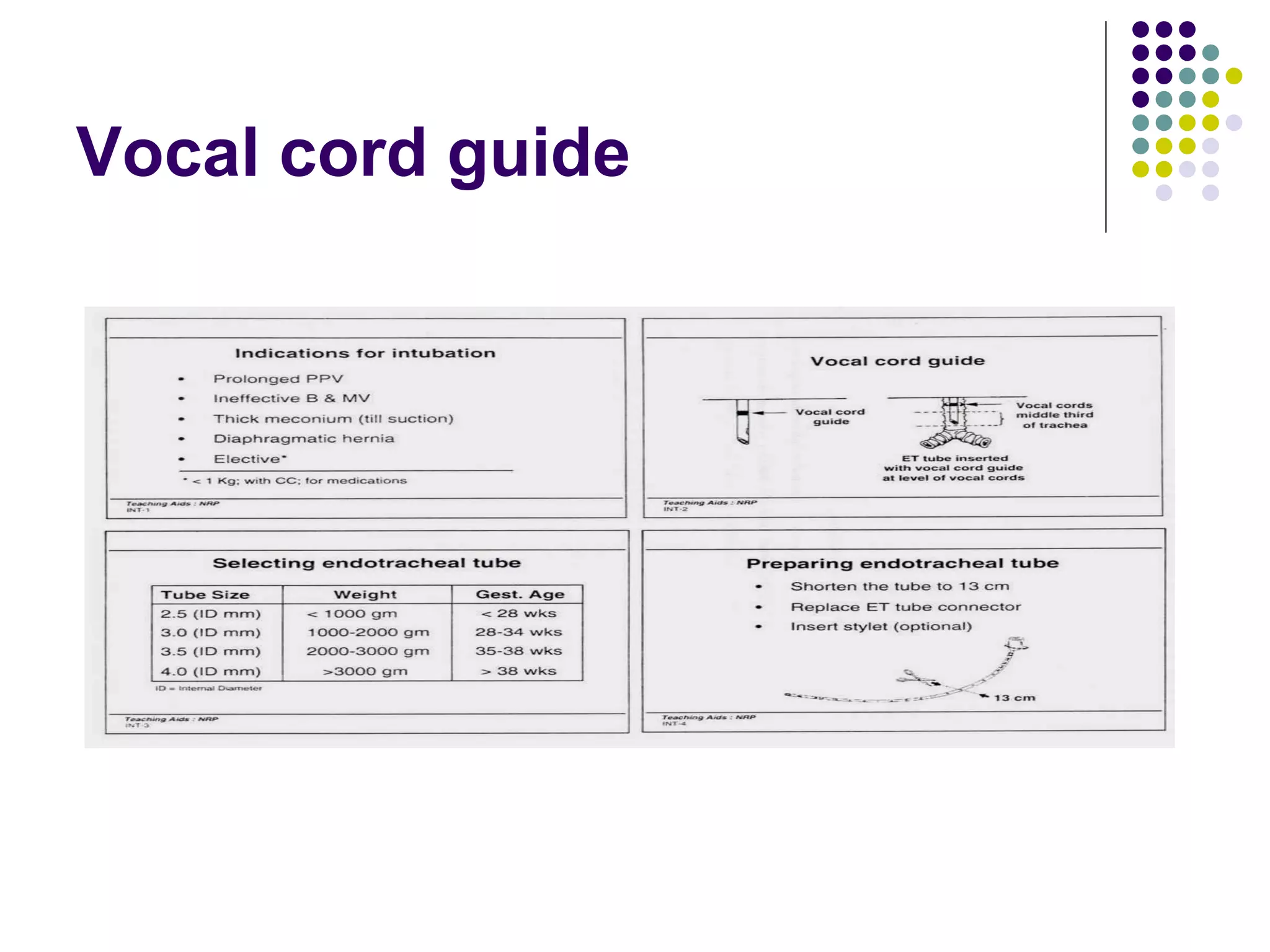 Vocal cord guide 