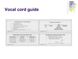 Vocal cord guide 