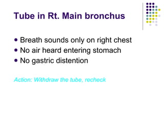 Tube in Rt. Main bronchus Breath sounds only on right chest No air heard entering stomach No gastric distention Action: Withdraw the tube, recheck 