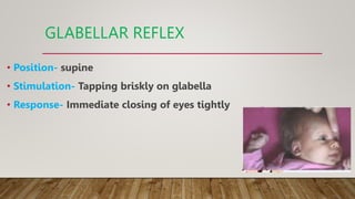Newborn Reflex.pptx