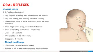 Newborn Reflexes PPT.pptx,,,,,,,,,,,,,,, | PPTX