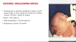 Newborn Reflexes PPT.pptx,,,,,,,,,,,,,,, | PPTX