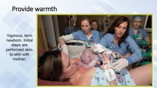 Provide warmth
Vigorous, term
newborn. Initial
steps are
performed skin-
to-skin with
mother.
 