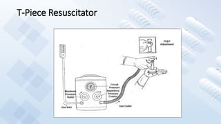 T-Piece Resuscitator
 