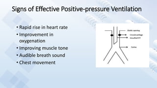 Signs of Effective Positive-pressure Ventilation
• Rapid rise in heart rate
• Improvement in
oxygenation
• Improving muscle tone
• Audible breath sound
• Chest movement
 