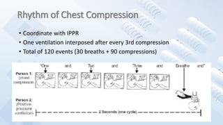 Rhythm of Chest Compression
• Coordinate with IPPR
• One ventilation interposed after every 3rd compression
• Total of 120 events (30 breaths + 90 compressions)
 