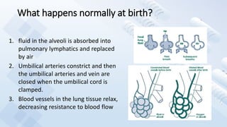 What happens normally at birth?
1. fluid in the alveoli is absorbed into
pulmonary lymphatics and replaced
by air
2. Umbilical arteries constrict and then
the umbilical arteries and vein are
closed when the umbilical cord is
clamped.
3. Blood vessels in the lung tissue relax,
decreasing resistance to blood flow
 