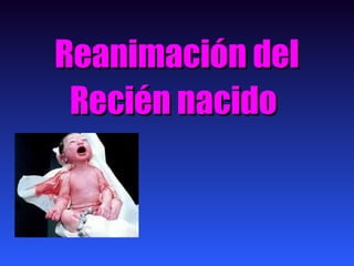 Reanimación delReanimación del
Recién nacidoRecién nacido
 