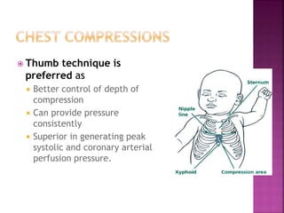  Depth : 1/3rd of the
anteroposterior
diameter of chest.
 Duration of
downward stroke
should be shorter
than the duratio...