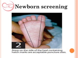 Newborn screening
 