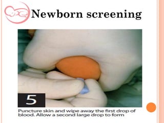 Newborn screening
 