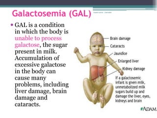 Galactosemia (GAL)       rosario anne r bernabe




 GAL is a condition
  in which the body is
  unable to process
  galactose, the sugar
  present in milk.
  Accumulation of
  excessive galactose
  in the body can
  cause many
  problems, including
  liver damage, brain
  damage and
  cataracts.
 
