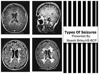 Types Of Seizures
    Presented By:
 Myeshi Briley,HS-BCP
 