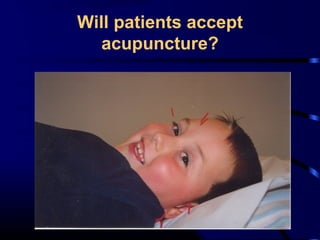 Will patients accept
acupuncture?

 