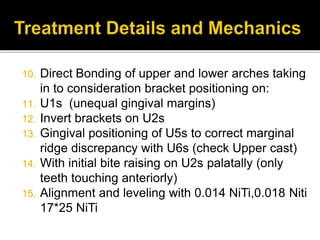 10. Direct Bonding of upper and lower arches taking
in to consideration bracket positioning on:
11. U1s (unequal gingival margins)
12. Invert brackets on U2s
13. Gingival positioning of U5s to correct marginal
ridge discrepancy with U6s (check Upper cast)
14. With initial bite raising on U2s palatally (only
teeth touching anteriorly)
15. Alignment and leveling with 0.014 NiTi,0.018 Niti
17*25 NiTi
 