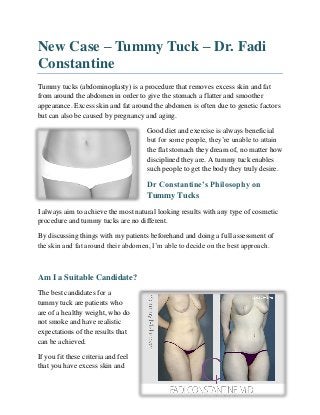 New Case – Tummy Tuck – Dr. Fadi
Constantine
Tummy tucks (abdominoplasty) is a procedure that removes excess skin and fat
from around the abdomen in order to give the stomach a flatter and smoother
appearance. Excess skin and fat around the abdomen is often due to genetic factors
but can also be caused by pregnancy and aging.
Good diet and exercise is always beneficial
but for some people, they’re unable to attain
the flat stomach they dream of, no matter how
disciplined they are. A tummy tuck enables
such people to get the body they truly desire.
Dr Constantine’s Philosophy on
Tummy Tucks
I always aim to achieve the most natural looking results with any type of cosmetic
procedure and tummy tucks are no different.
By discussing things with my patients beforehand and doing a full assessment of
the skin and fat around their abdomen, I’m able to decide on the best approach.
Am I a Suitable Candidate?
The best candidates for a
tummy tuck are patients who
are of a healthy weight, who do
not smoke and have realistic
expectations of the results that
can be achieved.
If you fit these criteria and feel
that you have excess skin and
 