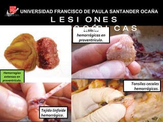 UNIVERSIDAD FRANCISCO DE PAULA SANTANDER OCAÑA Hemorragias extensas en proventrículo. Lesiones hemorrágicas en proventrículo. Tejido linfoide hemorrágico. Tonsilas cecales hemorrágicas. LESIONES MACROSCÓPICAS 