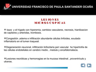 UNIVERSIDAD FRANCISCO DE PAULA SANTANDER OCAÑA LESIONES MICROSCOPICAS GRACIAS bazo  y el hígado con hiperemia, cambios vasculares, necrosis, hianilizacion de capilares y arteriolas, trombosis. Congestión ,edema e infiltración abundante células linfoides, exudado  inflamatorio en el lumen traqueal. Degeneración neuronal, infiltración linfocitaria peri vascular  he hipertrofia de las células endoteliales en cerebro medio , medula y encefalomalacia. Lesiones necróticas y hemorragias en la mucosa intestinal , proventrículo y ulceras. 