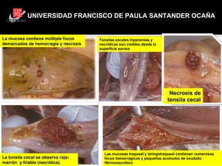 UNIVERSIDAD FRANCISCO DE PAULA SANTANDER OCAÑA GRACIAS Necrosis de tonsila cecal La mucosa contiene múltiple focos demarcados de hemorragia y necrosis La tonsila cecal se observa roja-marrón  y friable (necrótica). Tonsilas cecales hiperemias y necróticas son visibles desde la superficie serosa Las mucosas traqueal y laringotraqueal contienen numerosos focos hemorrágicos y pequeños acúmulos de exudado fibrinonecrótico 
