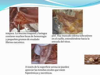 tráquea. La mucosa traqueal y laríngea contiene muchos focos de hemorragia y pequeños grumos de exudado fibrino-necrótico.piel. Hay marcado edema subcutáneo en el cuello, extendiéndose hacia la entrada del tórax.A través de la superficie serosa se pueden apreciar las tonsilas cecales que están hiperémicas y necróticas.