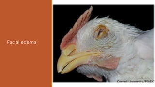 Facial edema
 