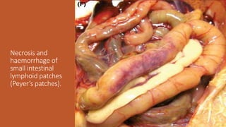 Necrosis and
haemorrhage of
small intestinal
lymphoid patches
(Peyer’s patches).
 