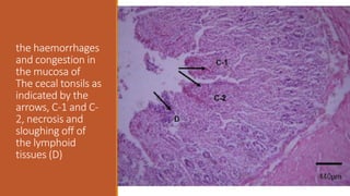 the haemorrhages
and congestion in
the mucosa of
The cecal tonsils as
indicated by the
arrows, C-1 and C-
2, necrosis and
sloughing off of
the lymphoid
tissues (D)
 