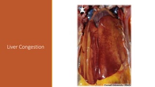 Liver Congestion
 