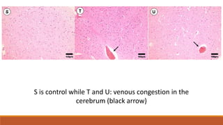 S is control while T and U: venous congestion in the
cerebrum (black arrow)
 