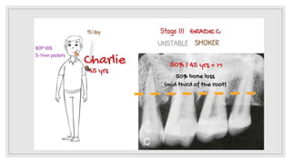 Upton Classification New classification.pptx