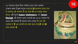 ২০ িতনির প্রথম সেনি আথতার কেনি বনল এিজে
ডািার প্রথম উনল্লখ্ িনরে িারনতর X জা়েগার কলাি কের
ই এিমাত্র এই িযান্সার টি ি়ে িারণ Y এর বযবিার িরার
জনেয। এটি মূলত lower abdomen এবং inner
thaigh এই জা়েগা গুনলা এনেক্ট ি়ে। ২০০৮ িানলর পর
কথনি এই িযান্সার টি অনেি িনম কগনছ। সি োম এই
িযান্সার ো Y এর োনমই োম িরণ িন়ে কগনছ? আর X
কিাে জা়েগা ?
118
16
 