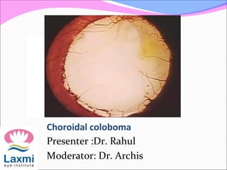 Choroidal coloboma
Presenter :Dr. Rahul
Moderator: Dr. Archis
 