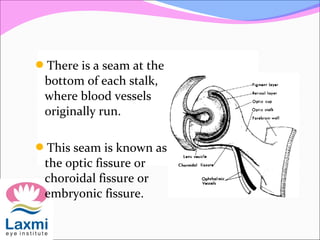 There is a seam at the
bottom of each stalk,
where blood vessels
originally run.
This seam is known as
the optic fissure or
choroidal fissure or
embryonic fissure.
 