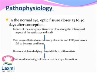 Pathophysiology
In the normal eye, optic fissure closes 33 to 40
days after conception.
Failure of the embryonic fissure to close along the inferonasal
aspect of the optic cup and stalk
That causes Retinal neurosensory elements and RPE precursors
fail to become confluent.
Due to which underlying choroid fails to differentiate
That results in bridge of bare sclera or a cyst formation
 