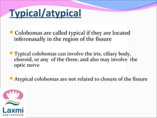 Typical/atypical
Colobomas are called typical if they are located
inferonasally in the region of the fissure
Typical colobomas can involve the iris, ciliary body,
choroid, or any of the three, and also may involve the
optic nerve
Atypical colobomas are not related to closure of the fissure
 