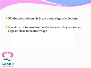 RD due to coloboma is break along edge of coloboma
It is difficult to visualise breaks because they are under
edge or close to haemorrhage
 