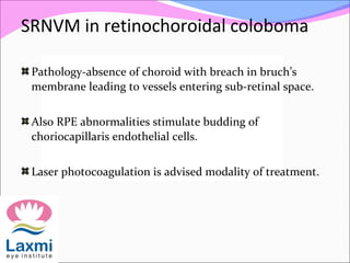 SRNVM in retinochoroidal coloboma
Pathology-absence of choroid with breach in bruch’s
membrane leading to vessels entering sub-retinal space.
Also RPE abnormalities stimulate budding of
choriocapillaris endothelial cells.
Laser photocoagulation is advised modality of treatment.
 