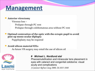 Management
 Anterior vitrectomy
Vitreous loss –
Prolapse through PC rent
Prolapse through colobomatous area without PC rent
 Optimal centeration of the optic with the ectopic pupil to avoid
post-op mono-ocular diplopia
Puppiloplasty may be required
 Avoid silicon material IOLs
As future VR surgery may entail the use of silicon oil
# Michael L. Nordlund etal
Phacoemulsification and intraocular lens placement in
eyes with cataract and congenital coloboma: visual
acuity and complications
J Cataract Refract Surg 2000; 26:1035-1040
 