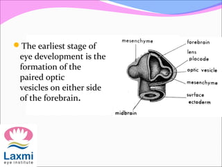The earliest stage of
eye development is the
formation of the
paired optic
vesicles on either side
of the forebrain.
 