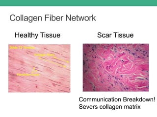 Collagen Fiber Network
Healthy Tissue Scar Tissue
Communication Breakdown!
Severs collagen matrix
 
