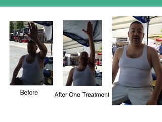 Before After One Treatment
 