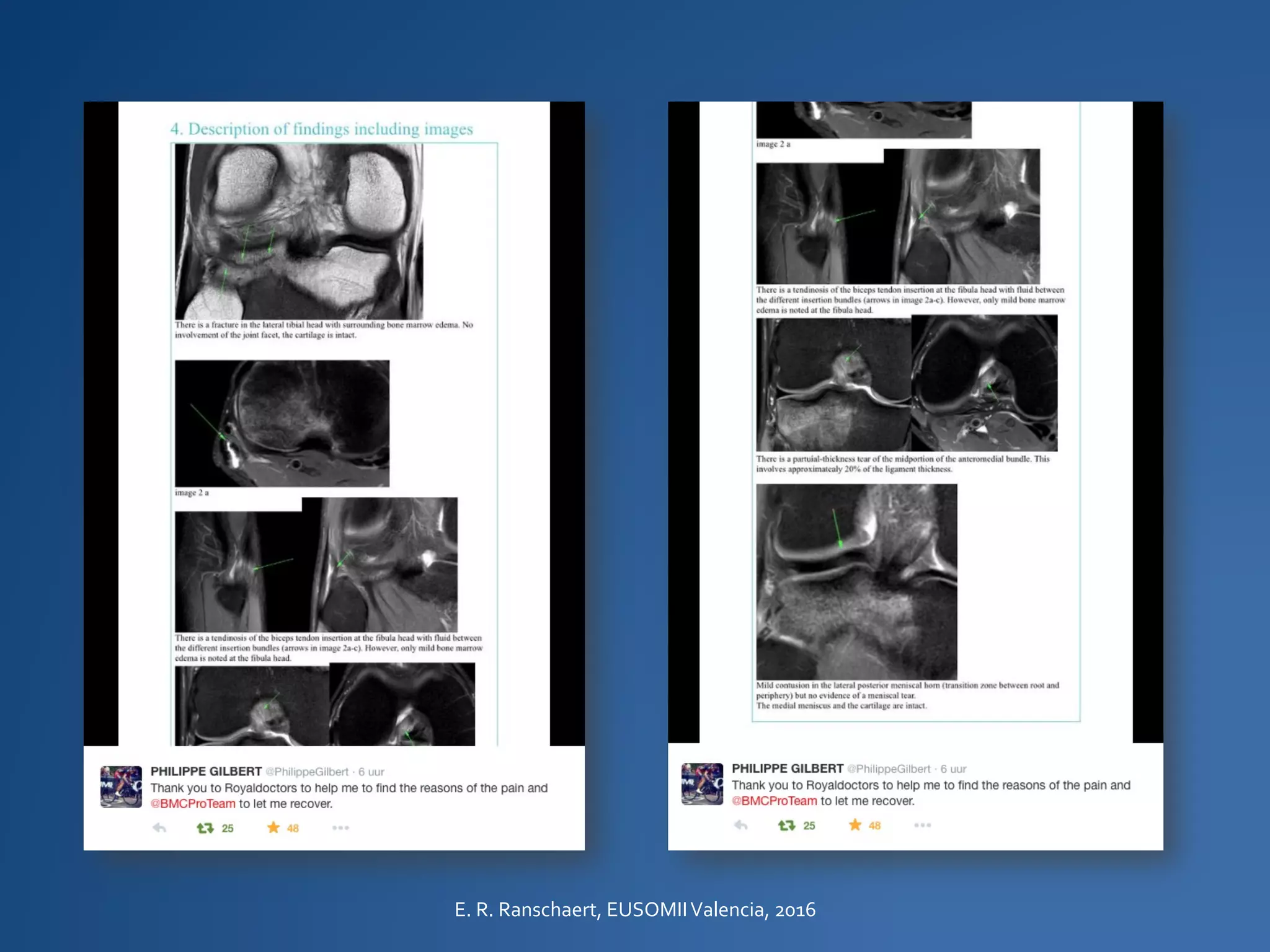 E. R. Ranschaert, EUSOMIIValencia, 2016
 
