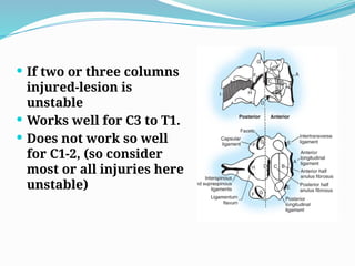  If two or three columns
injured-lesion is
unstable
 Works well for C3 to T1.
 Does not work so well
for C1-2, (so consider
most or all injuries here
unstable)
 