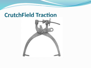 CrutchField Traction
 